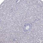 Anti-NRARP Antibody