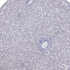 Immunohistochemical staining of human Liver shows no positivity in hepatocytes as expected.