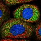 Immunofluorescent staining of human cell line A-431 shows localization to nucleoplasm & cytosol.