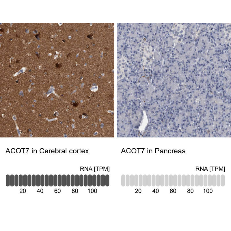 Anti-ACOT7 Antibody