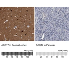 Anti-ACOT7 Antibody