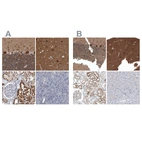 Immunohistochemical staining of human cerebellum, cerebral cortex, kidney and pancreas using Anti-ACOT7 antibody HPA025735 (A) shows similar protein distribution across tissues to independent antibody HPA025762 (B).
