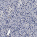 Immunohistochemical staining of human pancreas shows no positivity in exocrine glandular cells as expected.