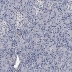 Immunohistochemical staining of human pancreas shows no positivity in exocrine glandular cells as expected.