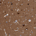 Immunohistochemical staining of human cerebral cortex shows strong cytoplasmic positivity in neurons.