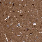 Immunohistochemical staining of human cerebral cortex shows strong cytoplasmic positivity in neurons.