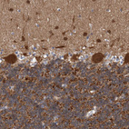Immunohistochemical staining of human cerebellum shows strong cytoplasmic positivity in Purkinje cells.
