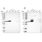 Western blot analysis using Anti-ACOT7 antibody HPA025735 (A) shows similar pattern to independent antibody HPA025762 (B).