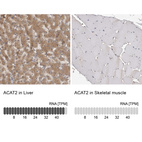 Anti-ACAT2 Antibody