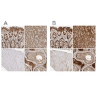 Immunohistochemical staining of human gastrointestinal, liver, skeletal muscle and testis using Anti-ACAT2 antibody HPA025736 (A) shows similar protein distribution across tissues to independent antibody HPA025765 (B).
