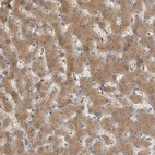 Anti-ACAT2 Antibody