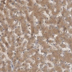 Immunohistochemical staining of human liver shows moderate cytoplasmic positivity in hepatocytes.