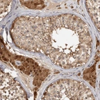 Immunohistochemical staining of human testis shows strong cytoplasmic positivity in Leydig cells.
