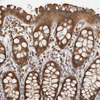 Immunohistochemical staining of human rectum shows strong cytoplasmic positivity in glandular cells.
