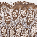 Immunohistochemical staining of human rectum shows strong cytoplasmic positivity in glandular cells.