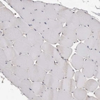 Immunohistochemical staining of human skeletal muscle shows no positivity in myocytes as expected.