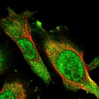 Immunofluorescent staining of human cell line U-251 MG shows localization to nucleoplasm & cytosol.