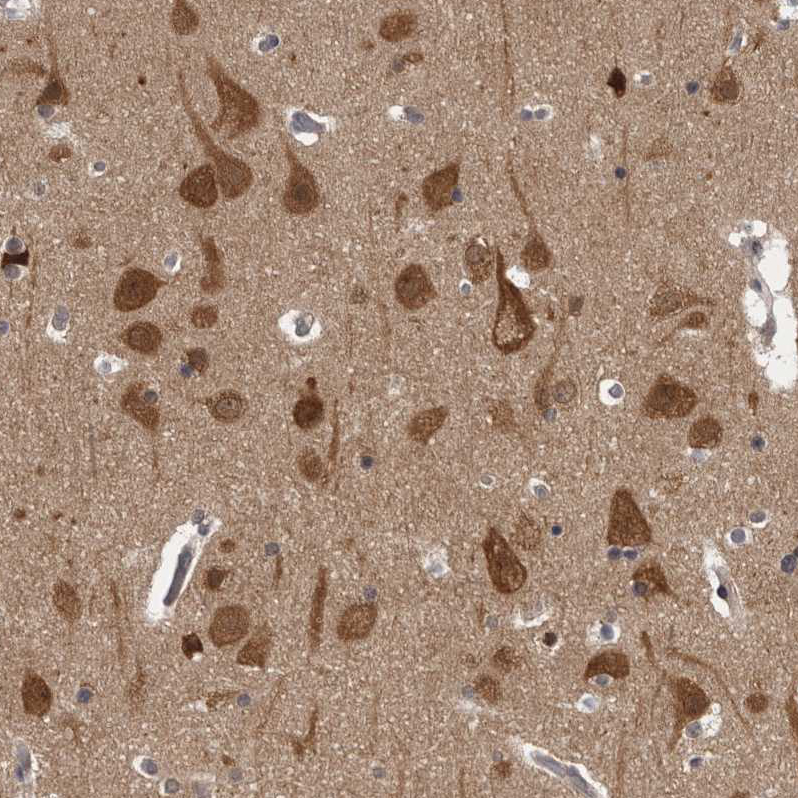 Anti-CACYBP Antibody