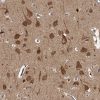 Anti-CACYBP Antibody