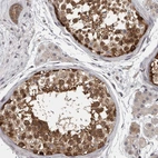 Immunohistochemical staining of human testis shows strong cytoplasmic positivity in cells in seminiferous ducts.