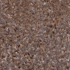 Immunohistochemical staining of human lymph node shows moderate cytoplasmic positivity in non-germinal center cells.