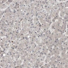 Immunohistochemical staining of human liver shows no positivity in hepatocytes as expected.