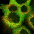 Immunofluorescent staining of human cell line A-431 shows localization to nucleoplasm & cytosol.