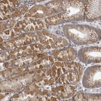 Anti-EDEM3 Antibody
