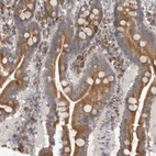 Immunohistochemical staining of human duodenum shows strong cytoplasmic positivity in glandular cells.