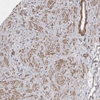 Immunohistochemical staining of human prostate shows moderate cytoplasmic positivity in smooth muscle cells.