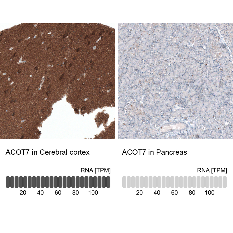 Anti-ACOT7 Antibody