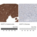 Anti-ACOT7 Antibody