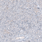 Immunohistochemical staining of human pancreas shows weak to no positivity in exocrine glandular cells as expected.