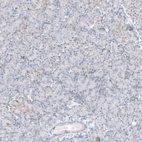 Immunohistochemical staining of human pancreas shows weak to no positivity in exocrine glandular cells as expected.