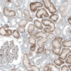 Immunohistochemical staining of human kidney shows moderate granular cytoplasmic positivity in cells in tubules.