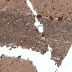 Immunohistochemical staining of human cerebellum shows strong cytoplasmic positivity in purkinje cells.