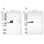 Western blot analysis using Anti-ACOT7 antibody HPA025762 (A) shows similar pattern to independent antibody HPA025735 (B).