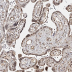 Anti-PHF3 Antibody