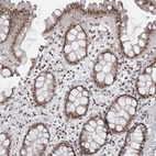 Immunohistochemical staining of human rectum shows strong nuclear positivity in glandular cells.