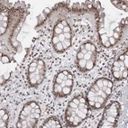 Immunohistochemical staining of human rectum shows strong nuclear positivity in glandular cells.