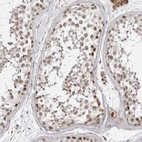 Immunohistochemical staining of human testis shows moderate nuclear positivity in cells in seminiferous ducts.
