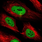 Immunofluorescent staining of human cell line U-2 OS shows localization to nucleoplasm.