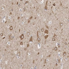Anti-TMEM242 Antibody