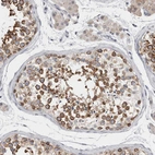 Immunohistochemical staining of human testis shows moderate to strong cytoplasmic and membranous positivity in cells in seminiferous ducts.