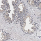 Immunohistochemical staining of human prostate shows weak membranous positivity in glandular cells.
