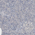 Immunohistochemical staining of human pancreas shows no positivity in exocrine glandular cells as expected.