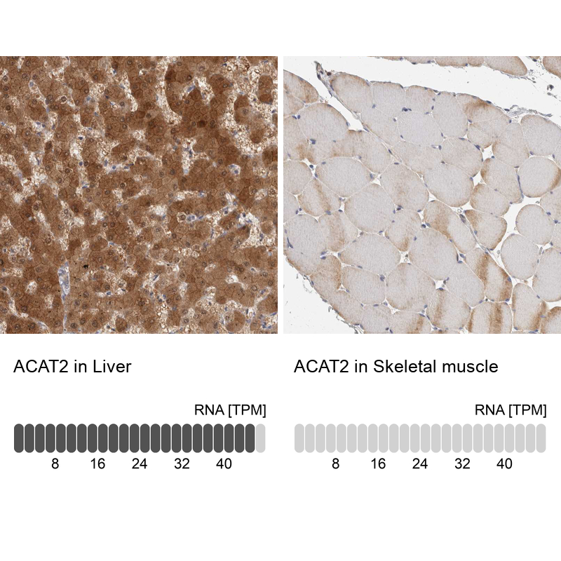 Anti-ACAT2 Antibody