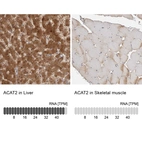 Anti-ACAT2 Antibody