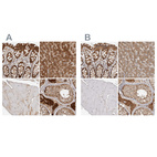 Immunohistochemical staining of human gastrointestinal, liver, skeletal muscle and testis using Anti-ACAT2 antibody HPA025765 (A) shows similar protein distribution across tissues to independent antibody HPA025736 (B).