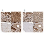 Immunohistochemical staining of human gastrointestinal, liver, skeletal muscle and testis using Anti-ACAT2 antibody HPA025765 (A) shows similar protein distribution across tissues to independent antibody HPA025736 (B).
